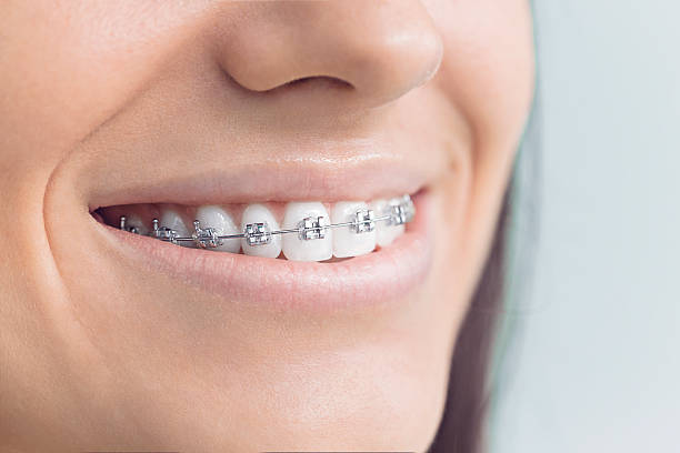 Dental X-Rays and Imaging in Berne, IN